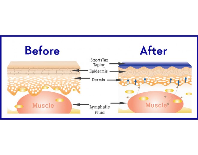 SportsTex Before After